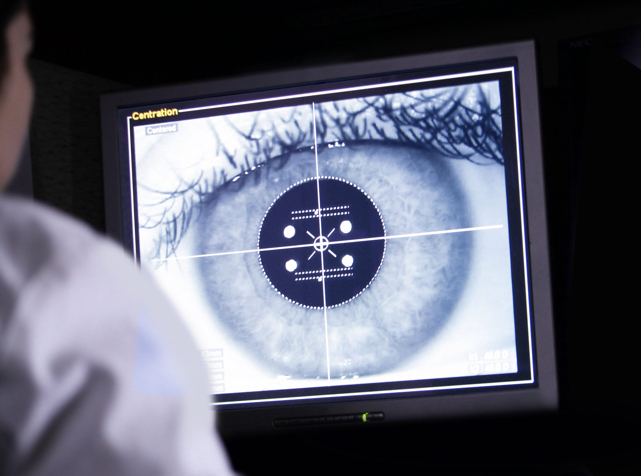 laser eye technology