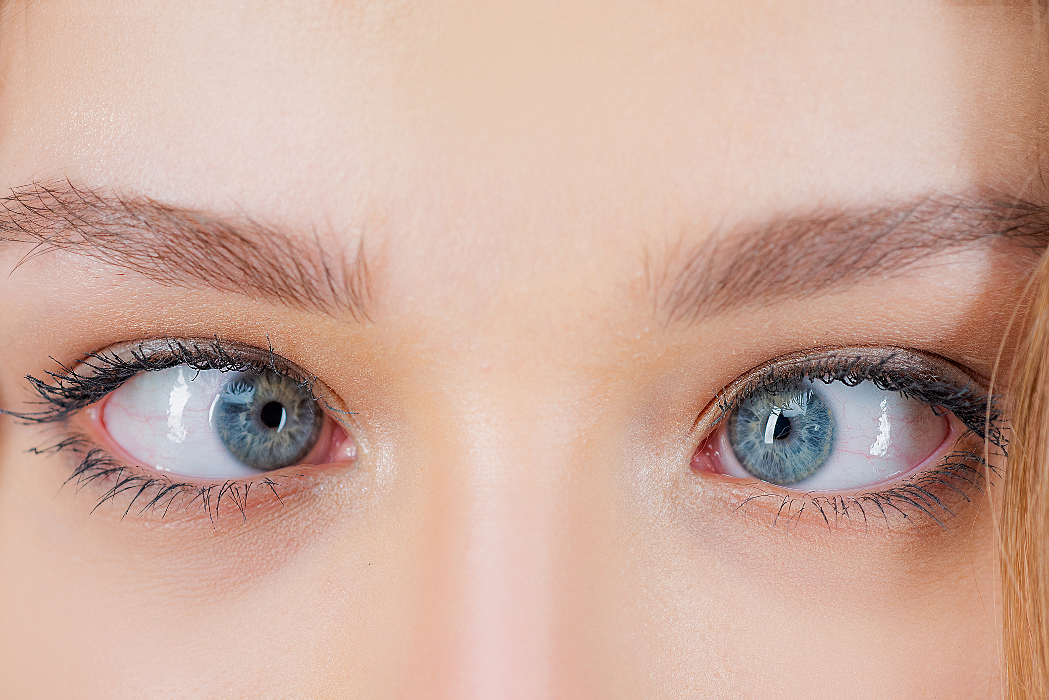 Discover the Treatment Alternatives for Strabismus